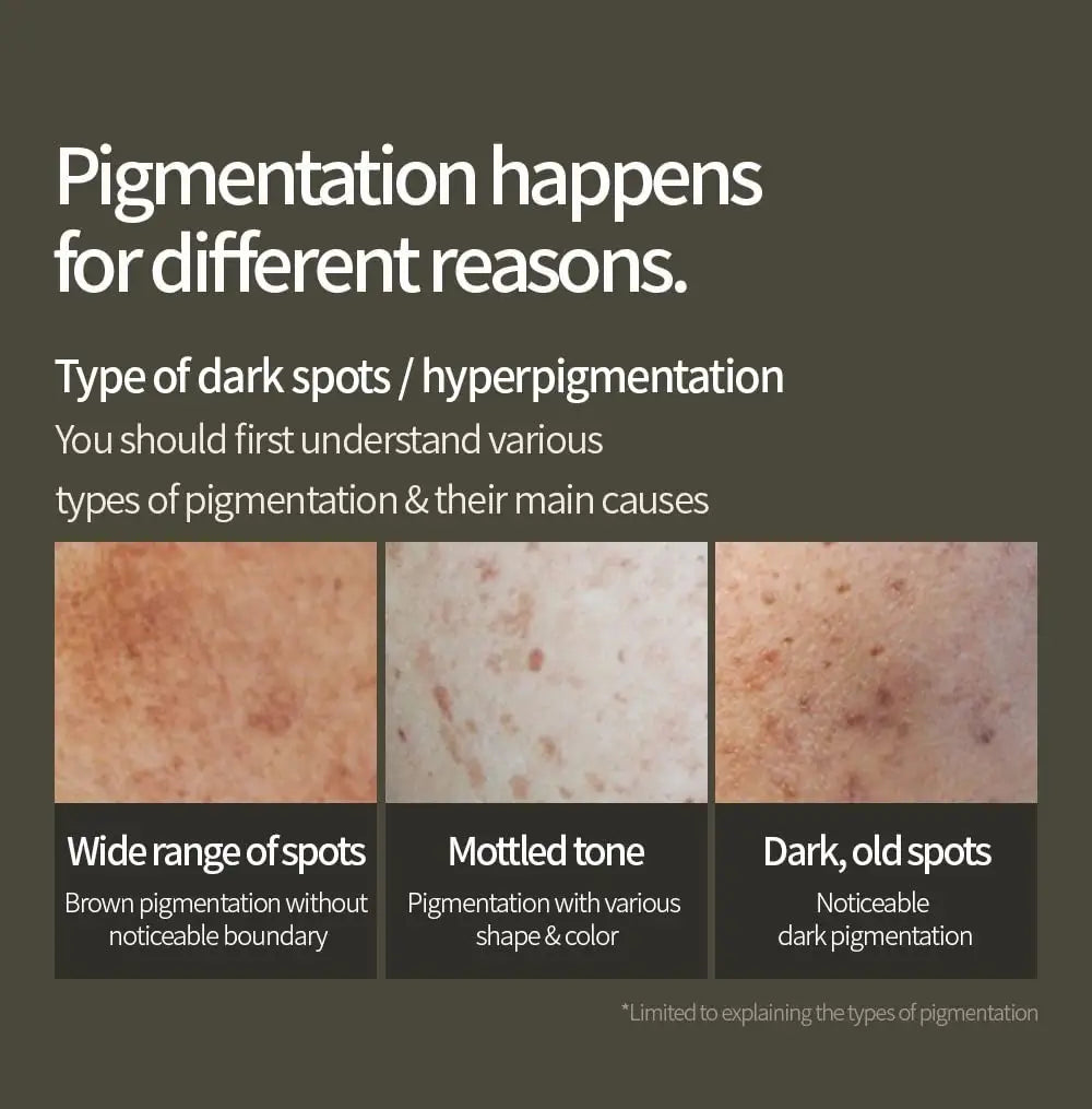 ANUA Green Lemon Vitamin C Blemish Serum