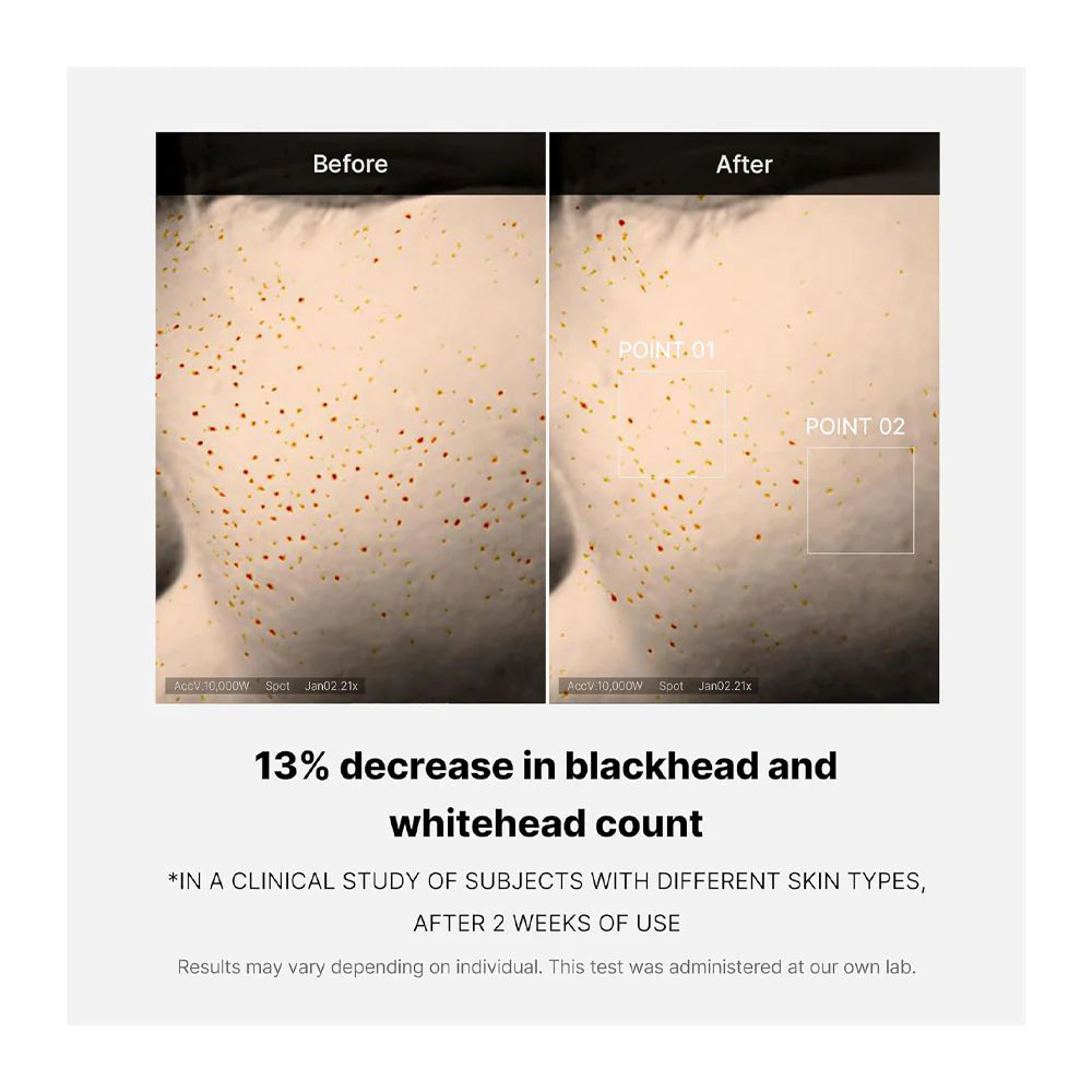 Zero Pore One-Day Serum