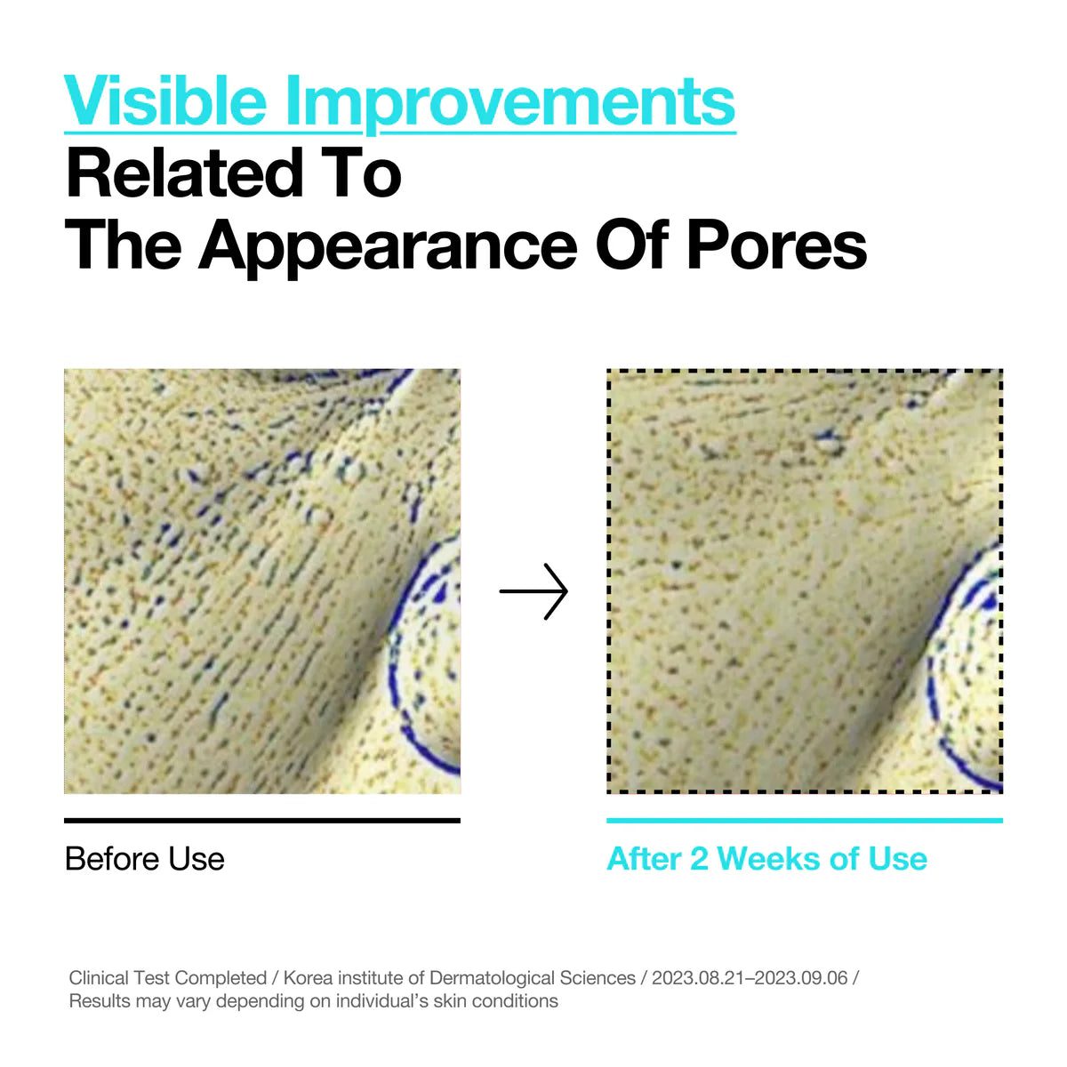 BHA 2% Gentle Exfoliating Toner